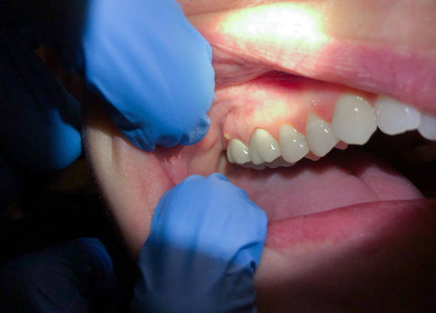 Best Root Canal Emergency Dentist  in Greenville, SC